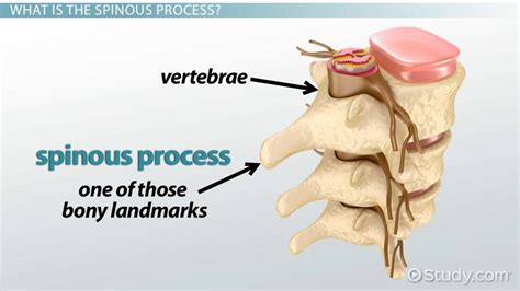 Spinous Process Function And Fracture Treatment Video And Lesson