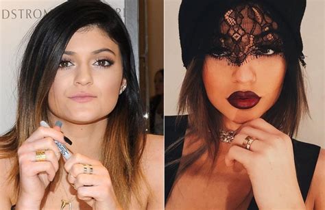 Kylie Jenner Plastic Surgery Is She Too Young