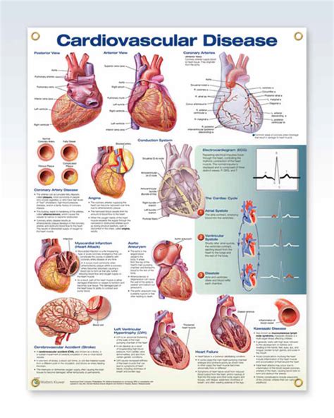 Cardiovascular Disease Exam Room Anatomy Posters