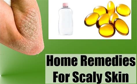 Home Remedies For Dry Skin How To Prevent Scaly Skin