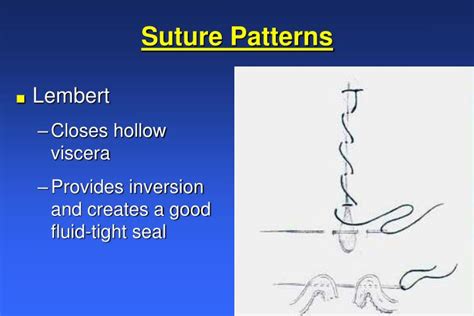 Ppt Wound Healing And Suture Knowledge Powerpoint Presentation Id