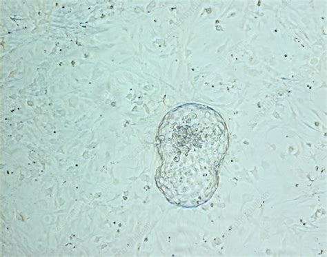 Human Blastocyst Light Micrograph Stock Image G Science