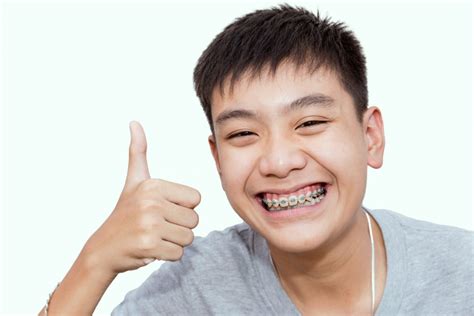 Guide 101 Everything To Consider About Braces For Kids