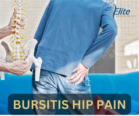 Hip Bursitis Causes Symptoms Treatments EPSI