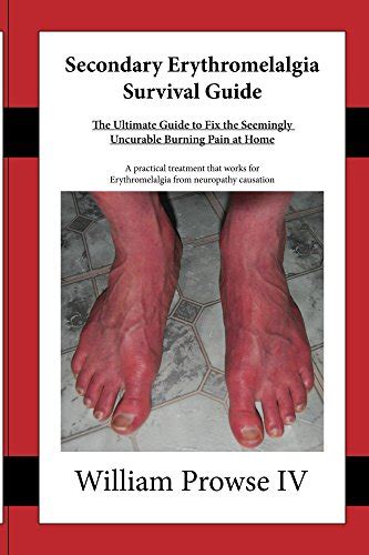 Secondary Erythromelalgia Survival Guide A Practical Treatment For