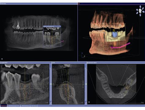 Cone Beam Cbct Technology Parker Dental Group Zanesville Ohio Dentist