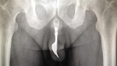 X Ray Penis In Vagina Cuming Sexy Photos Pheonix Money Page 2