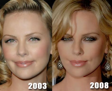 Charlize Theron Plastic Surgery Nose Job Breast Implants Before And After Photos