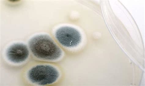 While toxic mold is not common in homes that are regularly maintained, this form of mold can be dangerous to a person's health. The Dangers of Mold Exposure