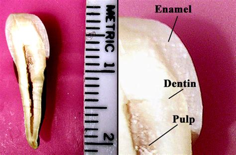 Segmental diagram of lung anatomy. Tooth enamel - wikidoc