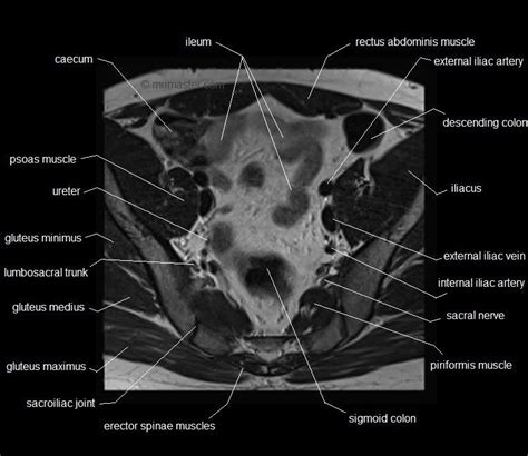 The pelvic bones are smaller and narrower. MRI pelvis anatomy | free male pelvis axial anatomy ...