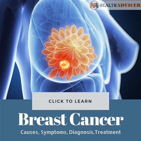 Breast Cancer Causes Picture Symptoms And Treatment