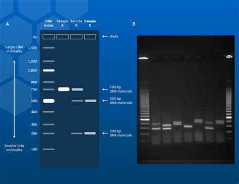 Electrophoresis Results