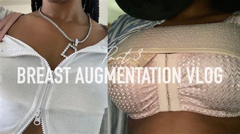 Breast Augmentation Vlog Part 3 Miami Girls Trip Pre Op Surgery Post Op Youtube