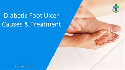 What Is Diabetic Foot Ulcer Causes And Treatment Zorg Health