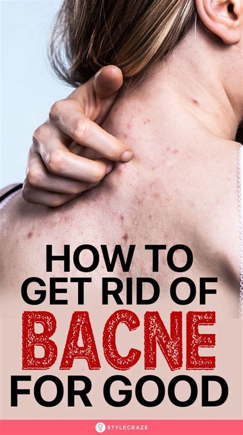 How To Get Rid Of Bacne For Good We Did Some Digging Around On The