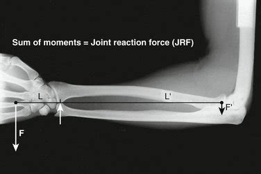 Stability Of The Distal Radioulnar Joint Clinical Gate
