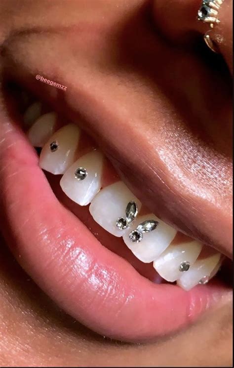 𝔭𝔦𝔫 𝔱𝔥𝔢𝔥𝔬𝔭𝔢𝔢𝔵𝔬 In 2021 Teeth Jewelry Tooth Gem Teeth Gems