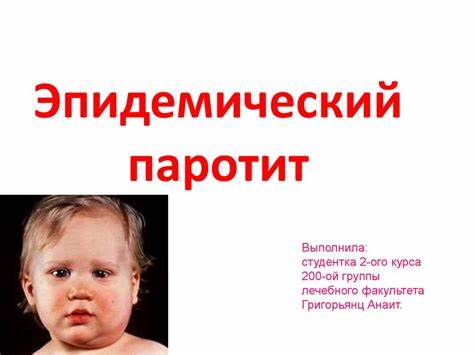 Эпидемический паротит диета ребенку Эпидемический паротит - презентация онлайн Эпидемический паротит - презентация онлайн Эпидемический паротит диета ребенку