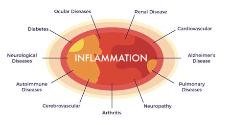 Chronic Inflammation Is That All There Is To Disease Ambrose Cell