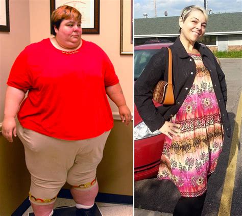 'My 600-lb Life' Before and After Photos - Where Are They Now? 