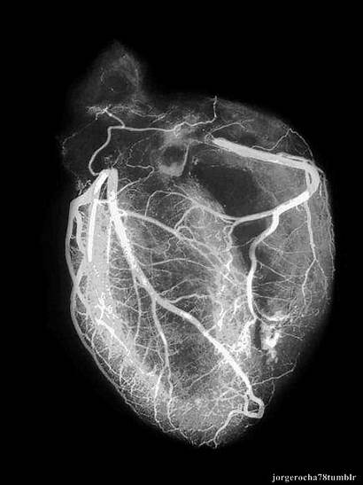 Heart Beating Medical Scan Animated Human Anatomy