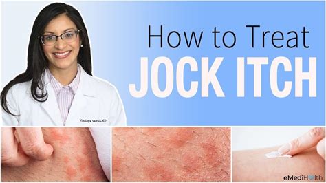 Jock Itch Causes Symptoms And Treatments Businessfig