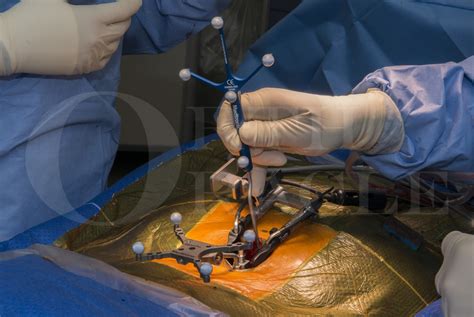 Lumbar Spine Surgery