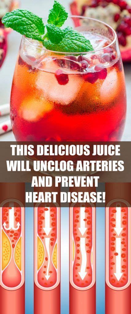 International journal of molecular sciences. This Delicious Juice Will Unclog Arteries and Prevent ...