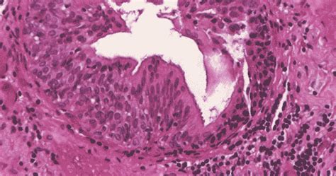 Glandular Epithelium Basic Histology