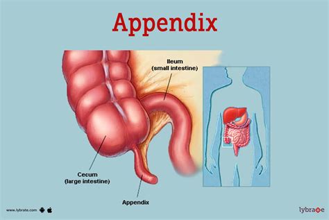 Appendix Human Anatomy Picture Function Diseases Tests And Treatments