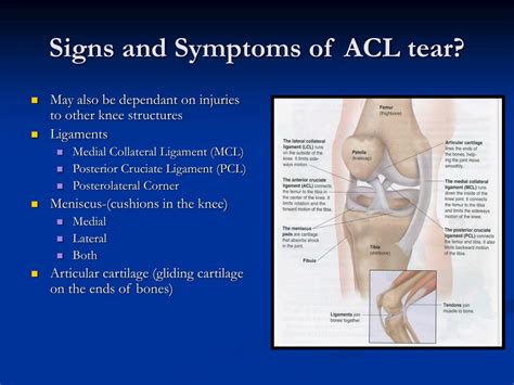 Acl Tear Swelling Pictures Anterior Cruciate Ligament Acl Injury