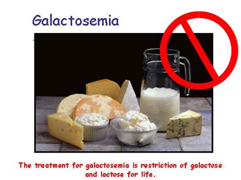تدابیر تغذیه ای و درمان بیماری گالاکتوزمی نبض ما