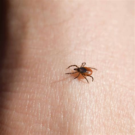 How To Recognize And Prevent Lyme Disease In Tick Season 2018