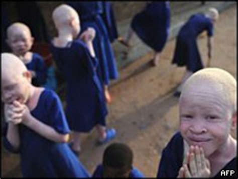Tanzania Detenido Por Intentar Vender A Un Albino BBC News Mundo