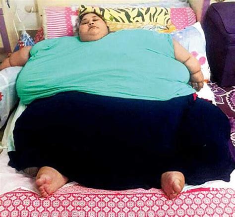 Worlds Heaviest Woman Eman Ahmed Loses Over 100 Kg In 3 Weeks Through