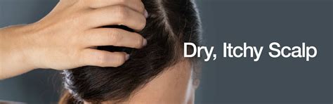 Dry Itchy Scalp Treatments Hairhouse Warehouse