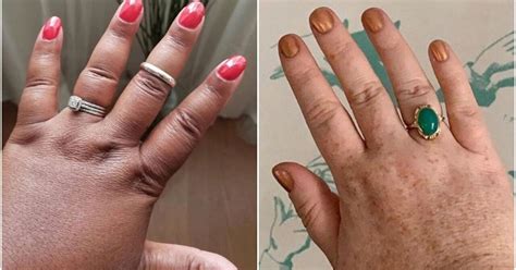chubby fingers are getting their due thanks to social media movement huffpost life