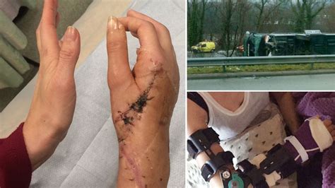 Gruesome Injuries Suffered By Brit Tourist In Horror Coach
