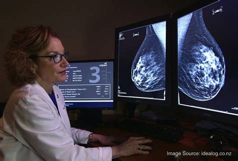 A Radiologists Perspectivethe Value Of Consistent Communication With Skin Markers In Mammography