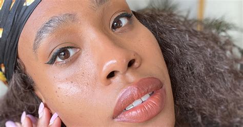 Turns Out Those “black Girl Freckles” Are Actually Dermatosis Papulosa Nigra Flipboard