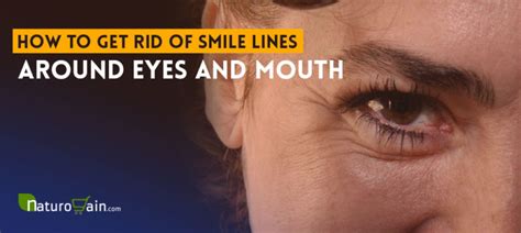 How To Get Rid Of Smile Lines Around Eyes And Mouth Naturally