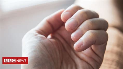 Como As Unhas Alertam Sobre Saúde E Ajudam A Detectar Doenças Bbc