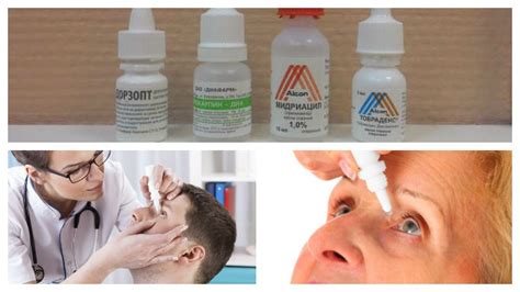 Симптомы и лечение кератита глаза - Глаза и их заболевания