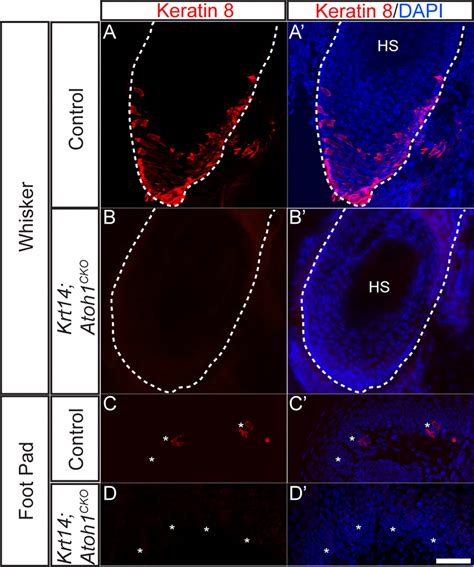 Rodents Rely On Merkel Cells For Texture Discrimination Tasks Journal