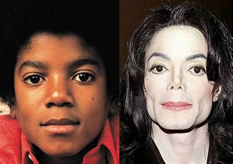 How Michael Jackson Struggled With Vitiligo And Turned White Face Face Africa