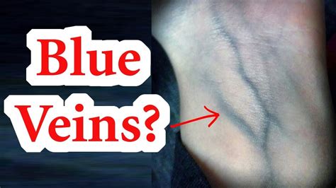 If Blood Is Red Why Are Veins Blue Youtube