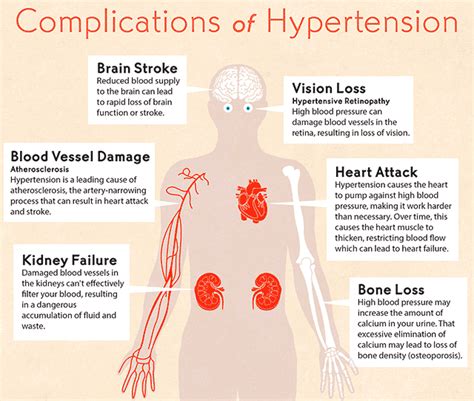 The Health Website : High Blood Pressure (Hypertension)