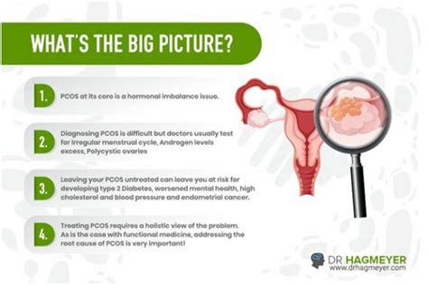 Pcos And The Big Picture Dr Hagmeyer