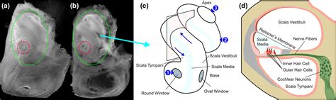 Two Photon Microscopy Of The Mouse Cochlea In Situ For Cellular Diagnosis
